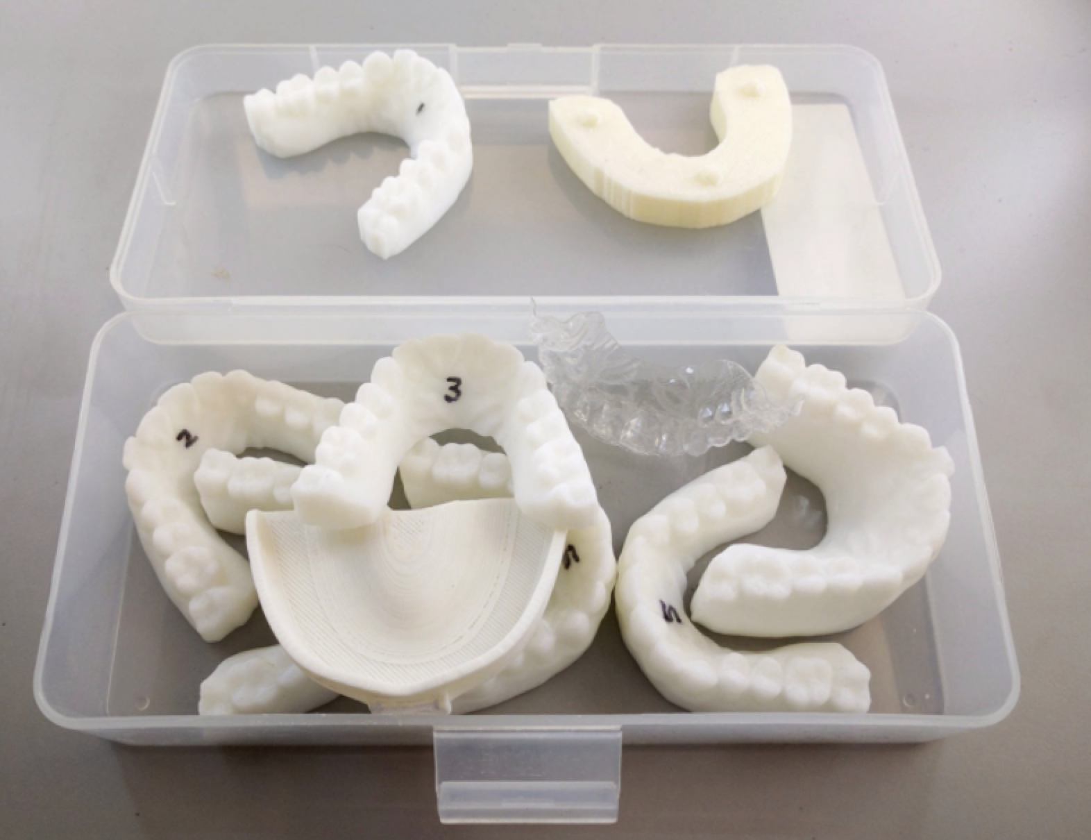 3d打印牙套:制作属于自己的定制化牙套 - 睿现科技——数字化制造工厂